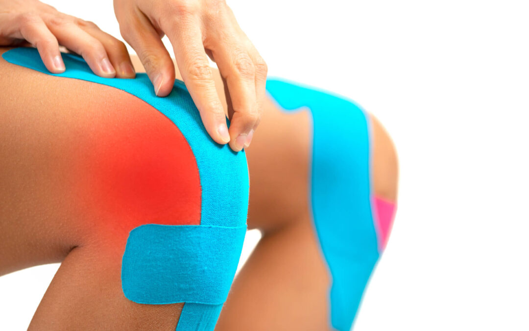L’efficacia del kinesio taping nell’artrosi del ginocchio