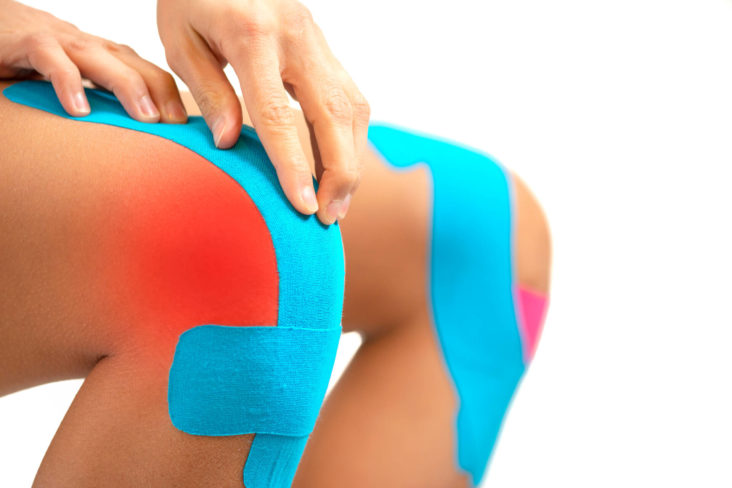 kinesio taping ginocchio